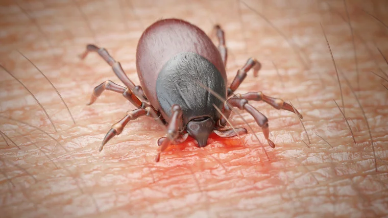 Łodzianie skarżą się na rosnącą aktywność kleszczy. Co zrobić, gdy znajdziemy pajęczaka na swojej skórze? - Zdjęcie główne