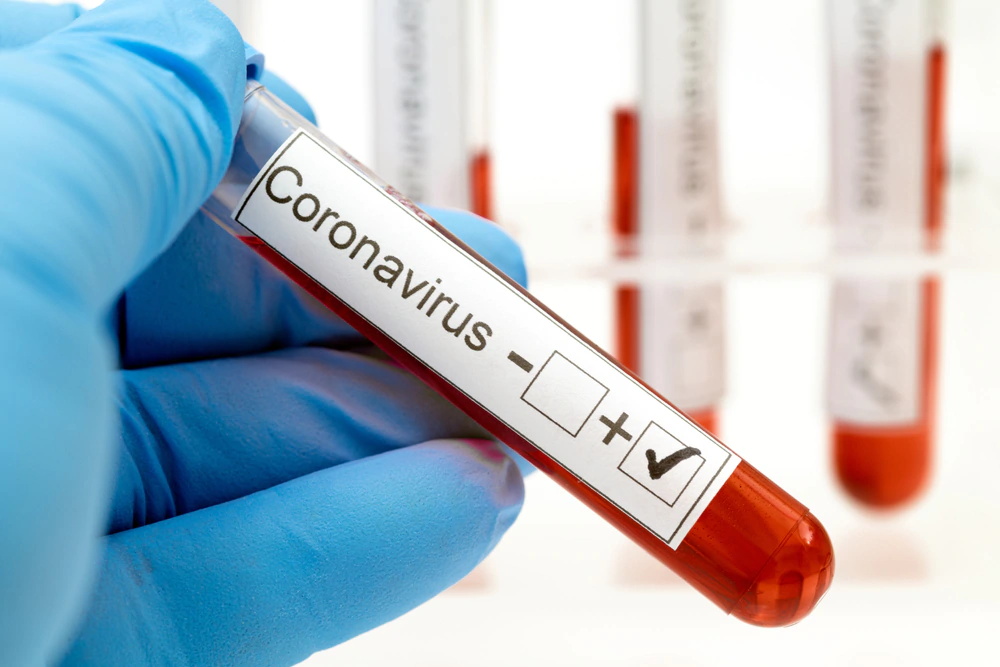 Koronawirus: w powiecie spada liczba zakażonych, już ponad 500 ozdrowieńców - Zdjęcie główne
