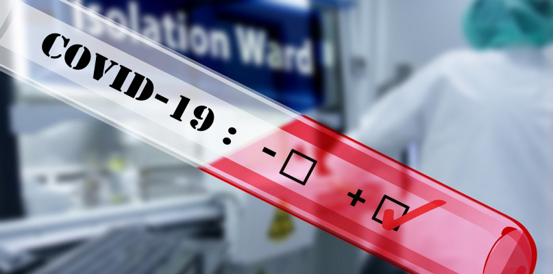 Koronawirus nie oszczędza nikogo. W Polsce zmarła 27-latka  - Zdjęcie główne