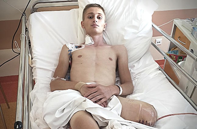 18-letni Kamil w wypadku stracił obie nogi. Chłopak walczy o powrót do normalności - Zdjęcie główne