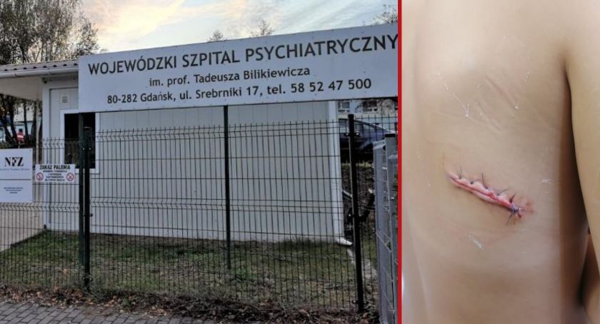 Pacjent zranił siekierą młodą pielęgniarkę. Trwa zbiórka na leczenie kobiety - Zdjęcie główne