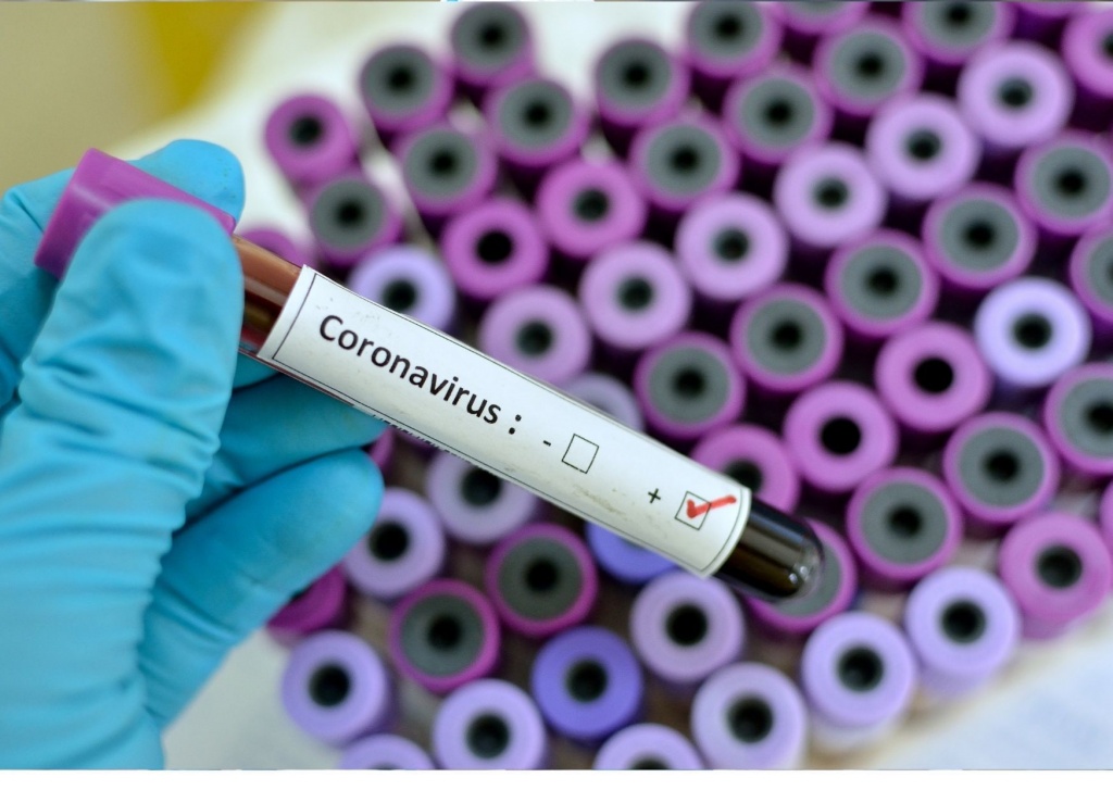 Koronawirus w Łódzkiem. 11 nowych zakażeń koronawirusem w Łódzkiem. Ponad 1,5 tys. mieszkańców ma kwarantannę [raport 25.08.21] - Zdjęcie główne