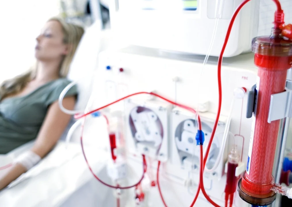 Pacjenci boją się o przyszłość stacji dializ w szpitalu w Zgierzu. Spór między WSS a DaVitą - Zdjęcie główne